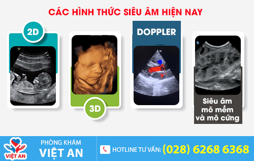 Các hình thức siêu âm hiện nay