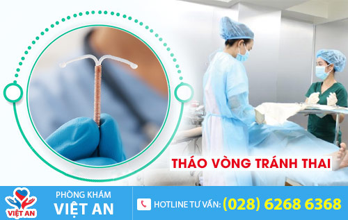 Tháo vòng tránh thai
